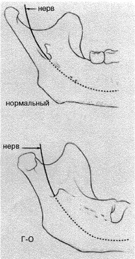 Иллюстрация к книге — Эректус бродит между нами. Покорение белой расы [p2511.jpg]