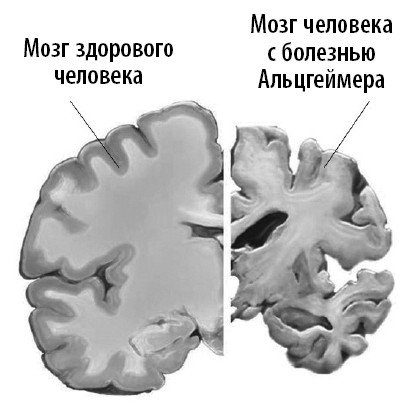 Иллюстрация к книге — Ваш мозг. Что нейронаука знает о мозге и его причудах [i_010.jpg]