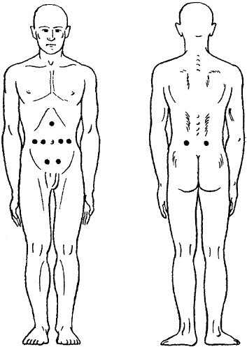 Остеохондроз и плоскостопие у мужчин. Супермен и соломинка. Профилактика, диагностика, лечение