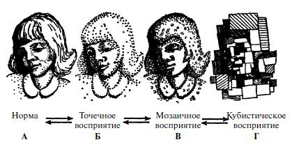 Мигрень