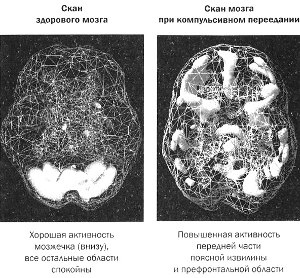 Мозг против лишнего веса