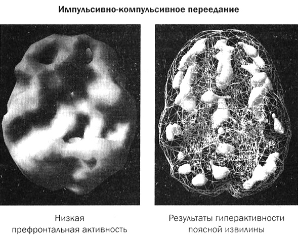 Мозг против лишнего веса