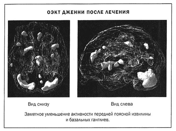 Мозг и душа. Новые открытия о влиянии мозга на характер, чувства, эмоции