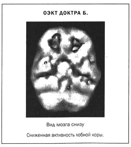 Мозг и душа. Новые открытия о влиянии мозга на характер, чувства, эмоции