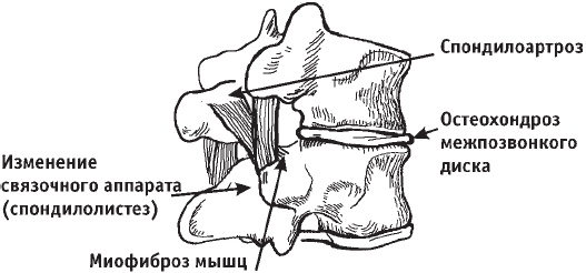 Первая скрипка позвоночника. Революционная методика лечения остеохондроза