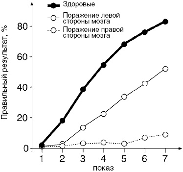 Антимозг. Цифровые технологии и мозг