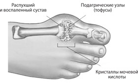 Чудо-вода