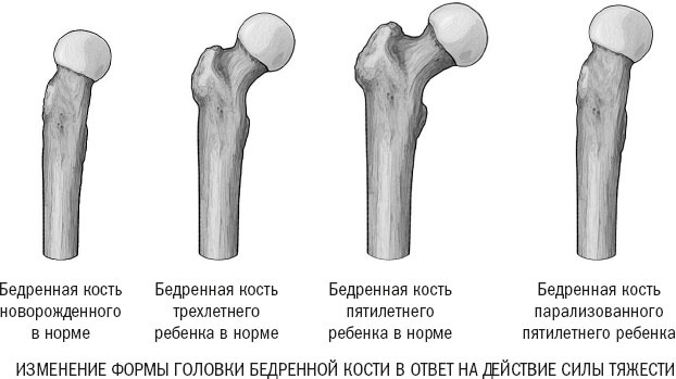 Йога при остеопорозе