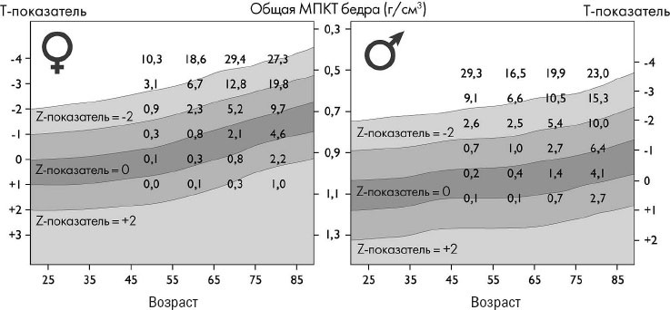 Йога при остеопорозе