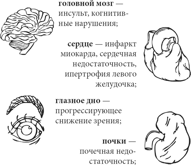 Высокое давление. Справочник пациента