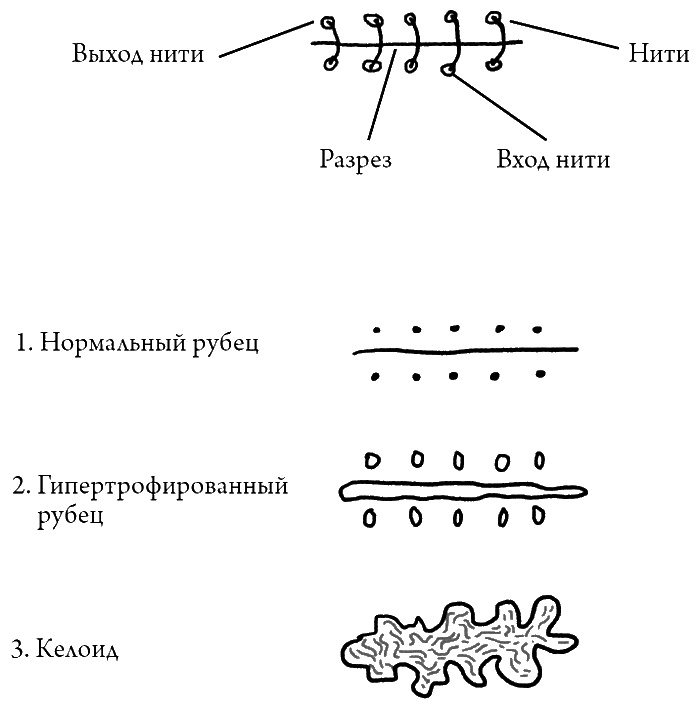 Что скрывает кожа. 2 квадратных метра, которые диктуют, как нам жить