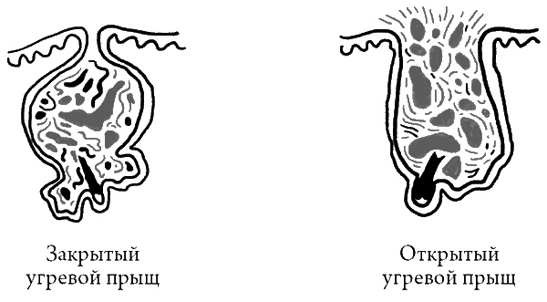 Что скрывает кожа. 2 квадратных метра, которые диктуют, как нам жить