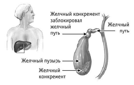 Фрукторианство. Новый взгляд на эволюцию питания человека