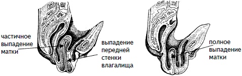 Гимнастика для женщин