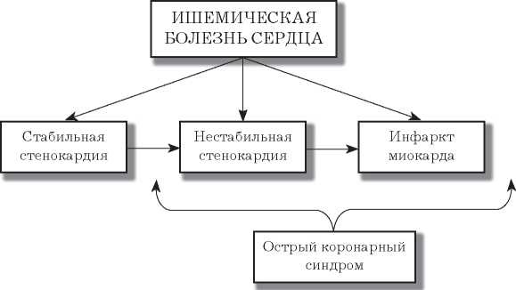 Стенокардия