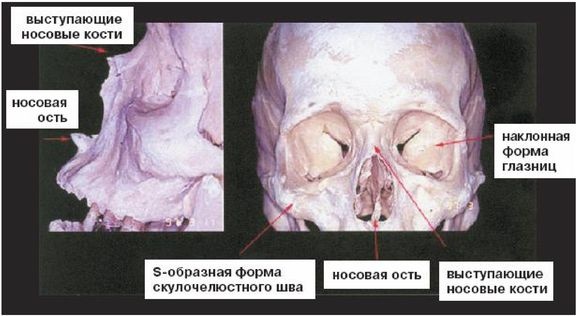 Эректус бродит между нами. Покорение белой расы