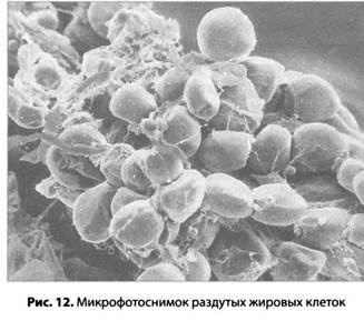 Психология стресса