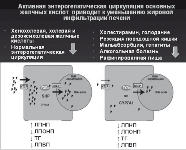 Неалкогольная жировая болезнь печени