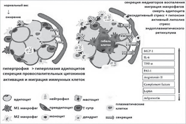 Неалкогольная жировая болезнь печени