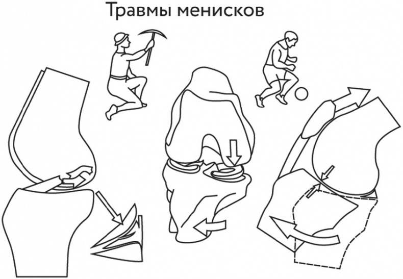 Азбука здоровья. Все о позвоночнике и суставах от А до Я