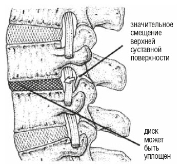 Настольная книга для тех, у кого болит спина