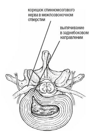 Настольная книга для тех, у кого болит спина