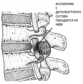 Настольная книга для тех, у кого болит спина