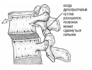 Настольная книга для тех, у кого болит спина