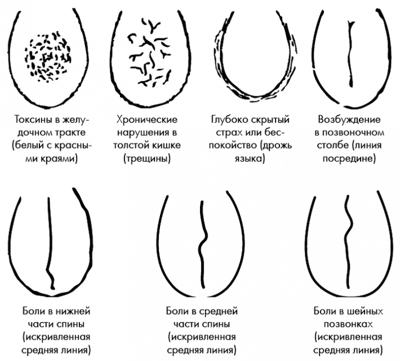 Су-Джок лечит. Мигрень, кашель, боль в спине, тяжесть в желудке