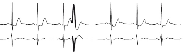 Что показывает кардиограмма