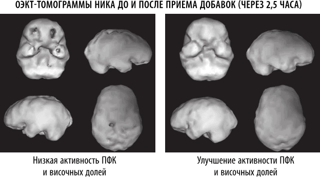 Полюби свой мозг