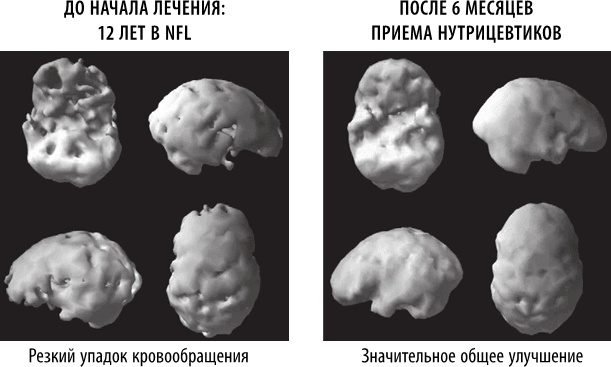 Полюби свой мозг