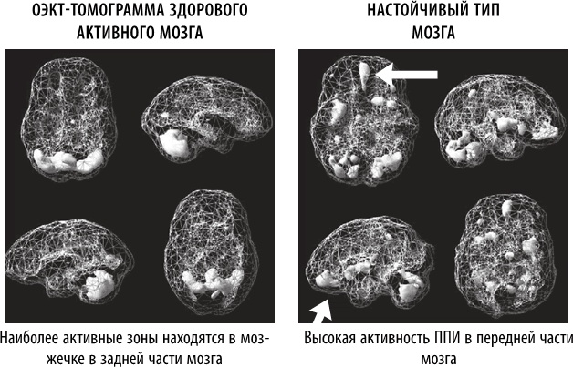 Полюби свой мозг