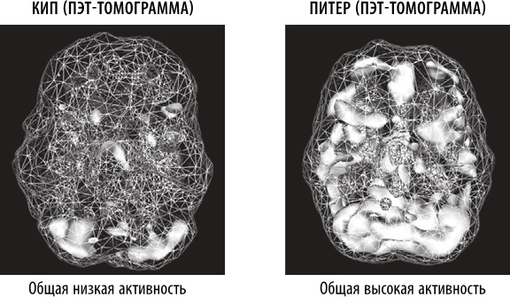 Мозг: от хорошего к превосходному [Дэниел Грегори Амен] (fb2) читать онлайн