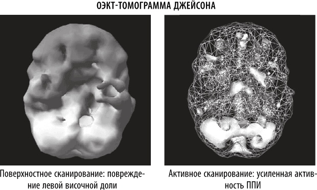 Полюби свой мозг