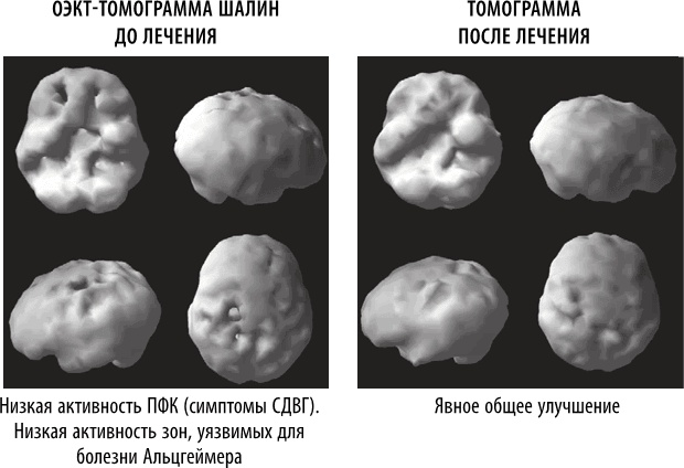 Полюби свой мозг