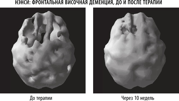 Полюби свой мозг