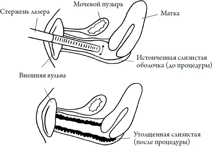 Человек Противный