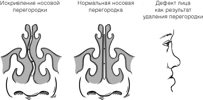 Челюсти. Научное исследование о взаимосвязи между зубами, мозгом и кишечником + 40-дневный план питания, который поможет вернуть в норму здоровье ротовой полости и сформировать иммунитет к кариесу