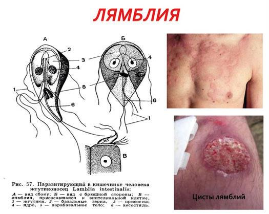 Аллергия. Истинные причины. Лечение