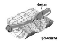 Взламывая анатомию