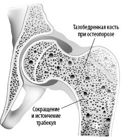 Взламывая анатомию