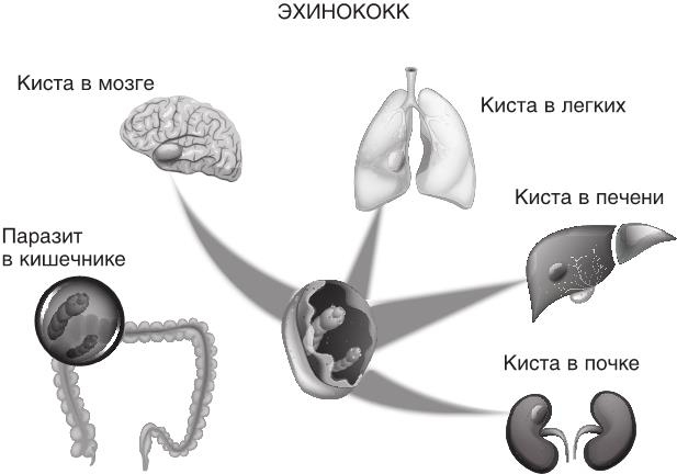 О чем молчит печень. Как уловить сигналы самого крупного внутреннего органа, который предпочитает оставаться в тени