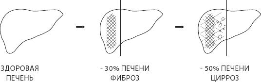 О чем молчит печень. Как уловить сигналы самого крупного внутреннего органа, который предпочитает оставаться в тени