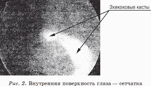 Иллюстрация к книге — Новые тайны нераспознанных диагнозов. Книга 2 [_05.png]