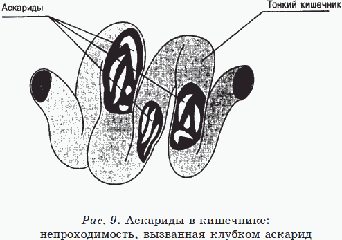 Иллюстрация к книге — Новые тайны нераспознанных диагнозов. Книга 3 [_18.png]