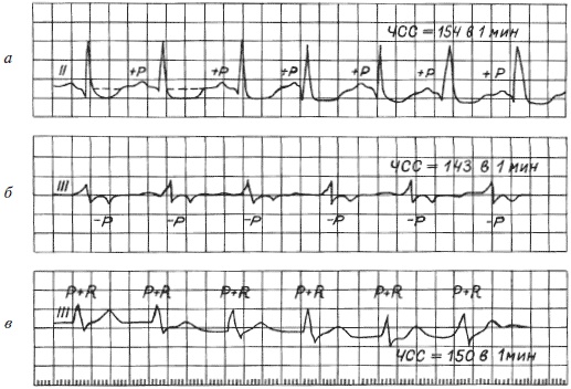 Иллюстрация к книге — Полный медицинский справочник фельдшера [Autogen_eBook_id17.jpg]