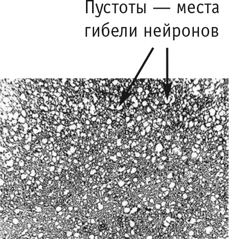Иллюстрация к книге — Многоликий вирус. Тайны скрытых инфекций [i_017.jpg]