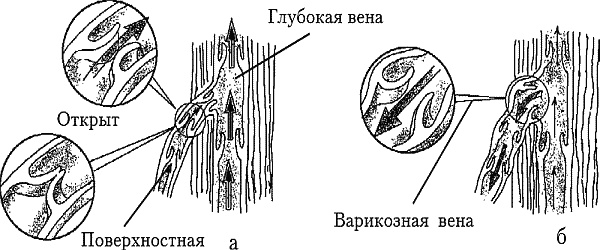 Иллюстрация к книге — Варикозное расширение вен. Лечение традиционными и нетрадиционными методами [_02.jpg]