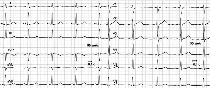 Иллюстрация к книге — Карманный справочник медицинских анализов [Autogen_eBook_id15.jpg]